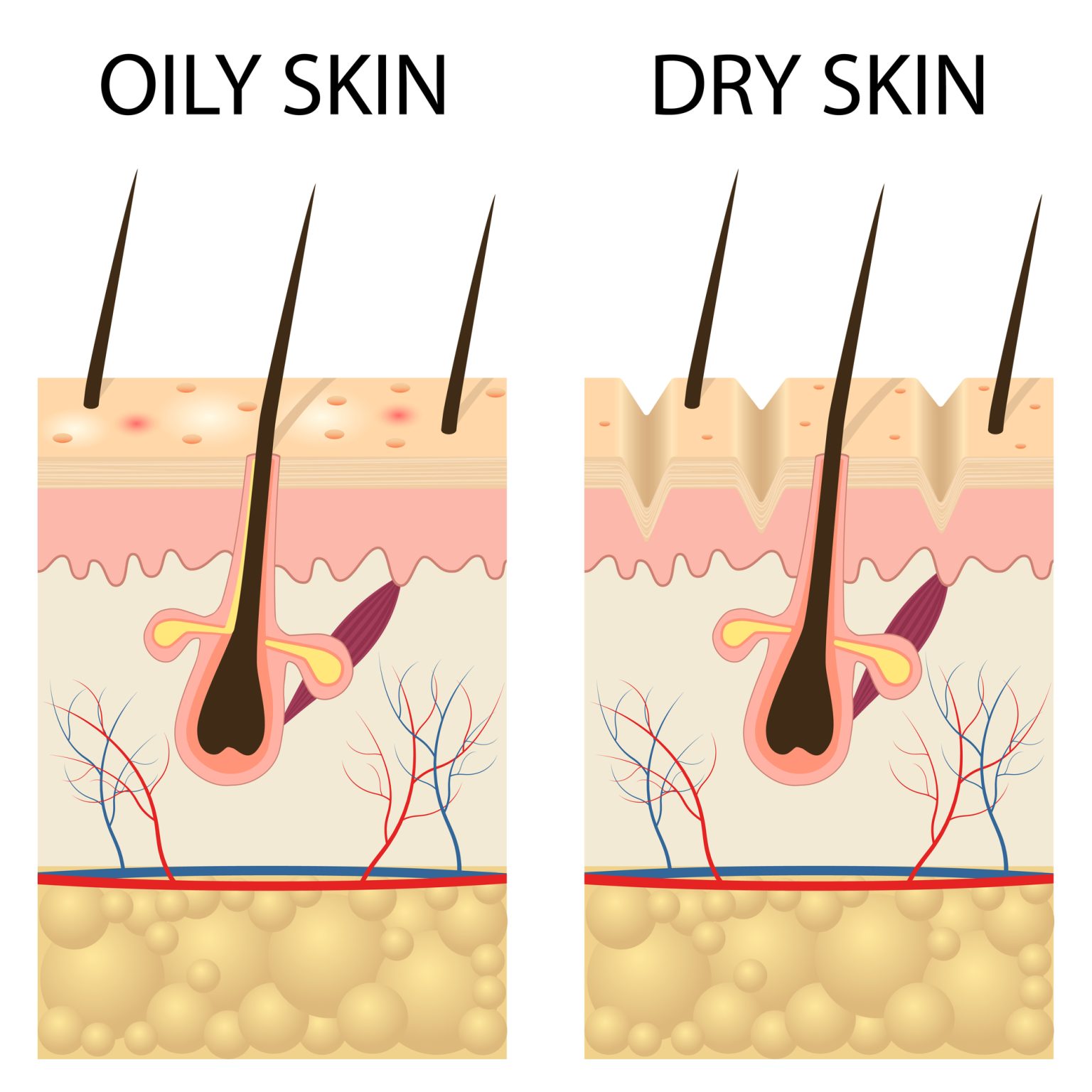 Qué relación hay entre el pelo graso y la caída del cabello ITC Medical