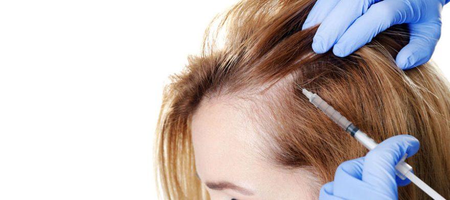 Rico en Plaquetas) combatir la alopecia ITC Medical