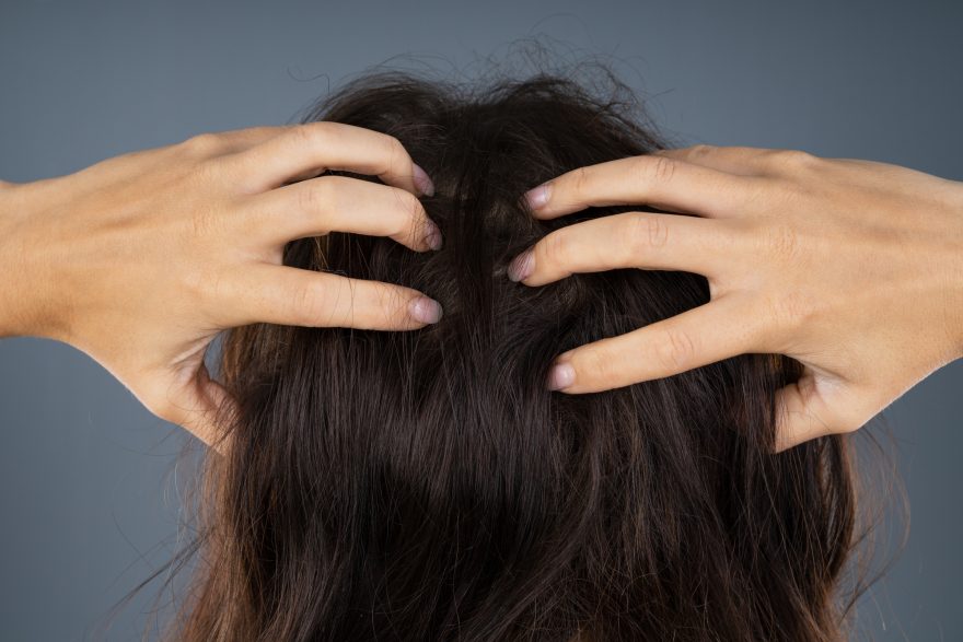 cómo prevenir la caída del cabello