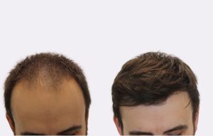 cas real 62 web 1 final