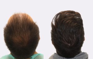 cas real 62 web 2 final