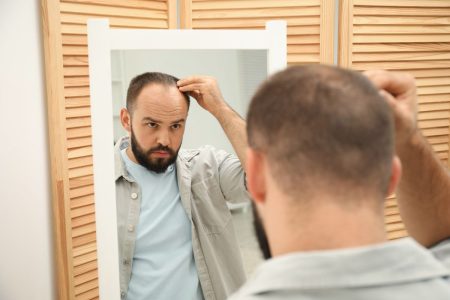 la calvicie de quien se hereda