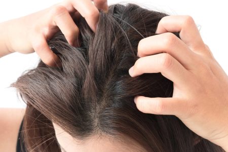 foliculitis cuero cabelludo