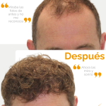 (español) (3)